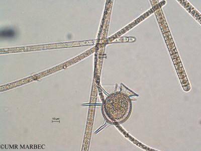 phyto/Scattered_Islands/all/COMMA April 2011/Dinophysis balechii (ancien Dinophysis sp2 -1)(copy)_thumb.jpg